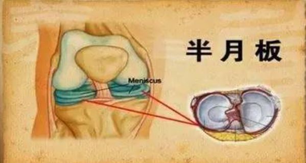 半月板再生最新成果，重塑关节健康的新希望曙光